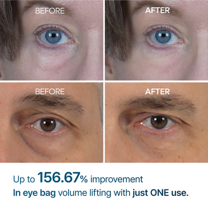 Dr Melaxin - Eyephalt Eyecream